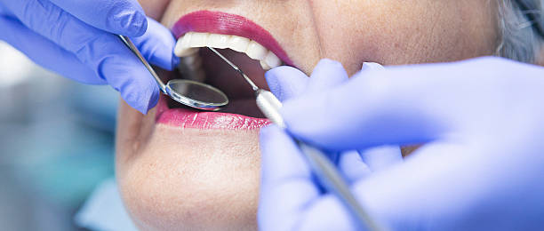 Best Emergency Tooth Extraction in Wmington, IL