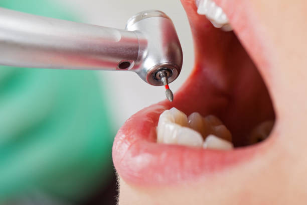 Best Emergency TMJ Treatment in Wmington, IL